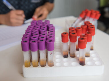 Brineura doses/battendiseasenews.com/animal models can predict doses