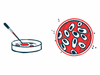 A petri dish illustration.